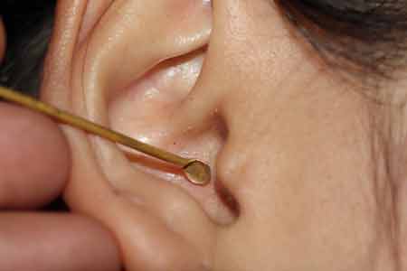 How to Apply Ear Wax Cleaner Properly