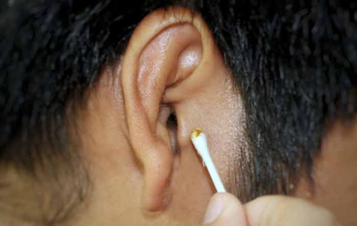 Proper Application Of Ear Wax Cleaner
